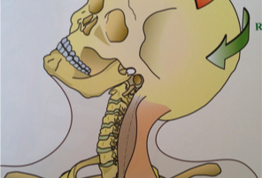 Head on cervical spine
